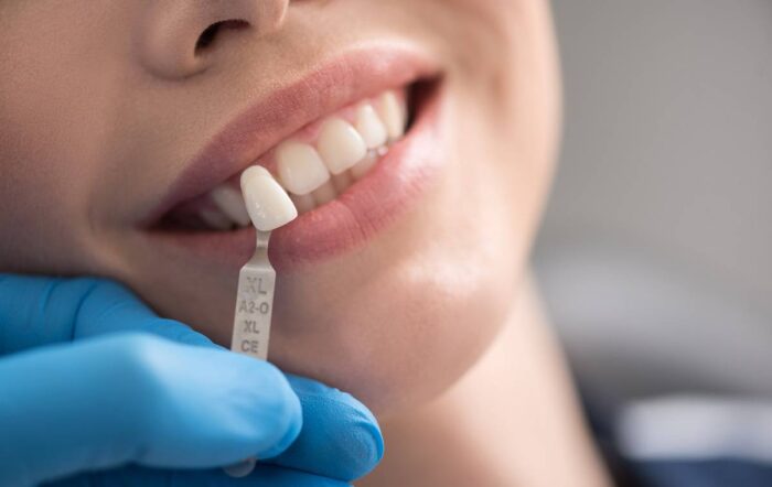 What Is The Cost Of A Single Tooth Implant?